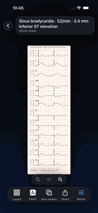 ECG Builder on iPhone